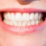 Zdrowe i mocne zęby bez próchnicy – zadbaj o nie już dziś. Próchnica i ból zębów – leczenie ,a także profilaktyka